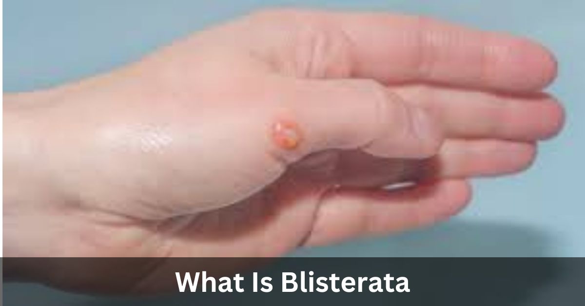 What Is Blisterata